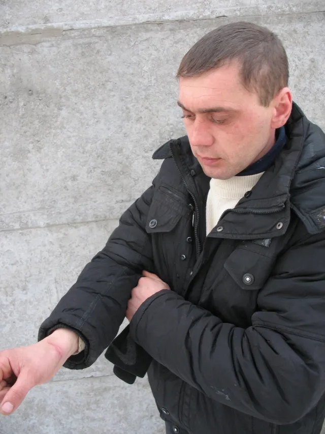 Міліціонери катували, та лякали чоловіка вбивством (Фоторепортаж) — фото 1