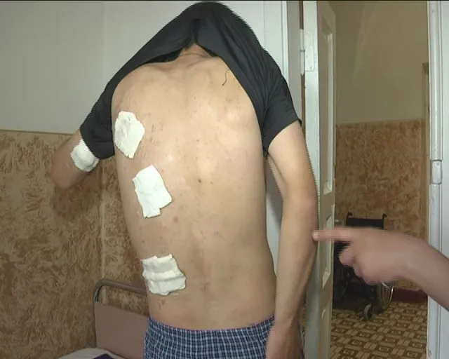 До луцького військового шпиталю привезли п'ятьох із поранених бійців під Волновахою (Фото) + (Відео) — фото 1